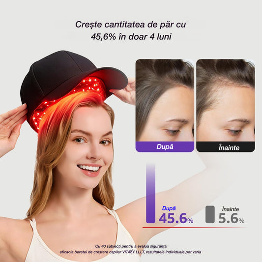 🧢 🔴Cască portabilă pentru terapie cu lumină pentru păr 🔋 Baterie încorporată ✨ Pentru bărbați și femei