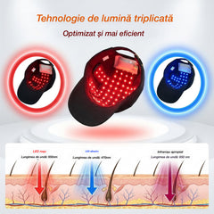 🧢 🔴Cască portabilă pentru terapie cu lumină pentru păr 🔋 Baterie încorporată ✨ Pentru bărbați și femei